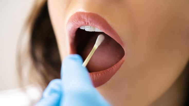 CBD et conduite : peut-on être positif au test salivaire ?